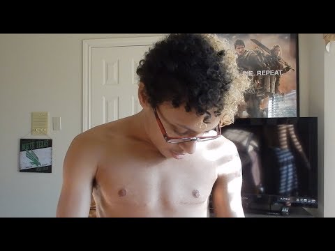 A Quick Summary of My Top Surgery Experience - Kai F.