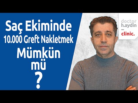 Saç Ekiminde 10.000 Greft Nakletmek Mümkün mü ? - Dr. Hamid AYDIN
