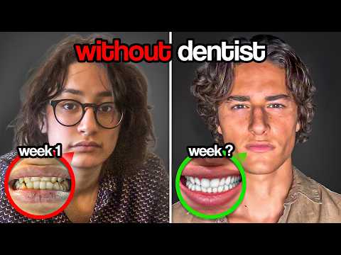 How To Fix Crooked Teeth NATURALLY | Full Guide