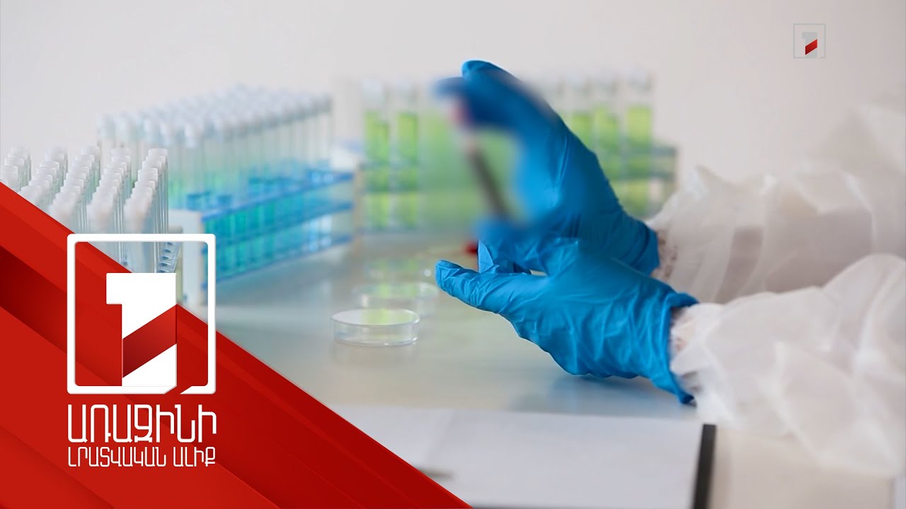 Այս տարվա առաջին տասն ամսում մեր երկրում արձանագրվել է ՄԻԱՎ-ով վարակվածության 462 դեպք