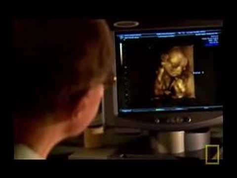 Click to Watch the America's Shame: Using Ultrasound Technology for Saving Babies and Killing Babies in the Womb video Click to Watch the America's Shame: Using Ultrasound Technology for Saving Babies and Killing Babies in the Womb video