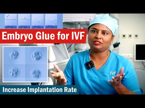 Embryo Glue for IVF | Increase Implantation Rate | Dr.G.Kavitha Embryologist  | Embryo Glue | Part 2