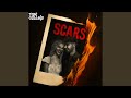Scars