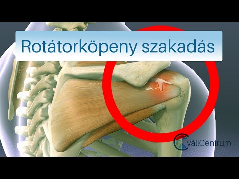 ízületi osteomyelitis kezelés