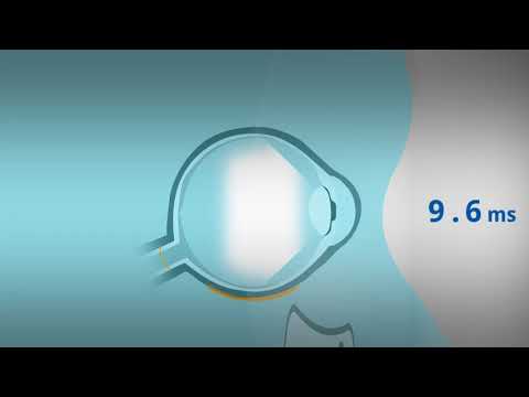 RETeval DR Protocol Overview