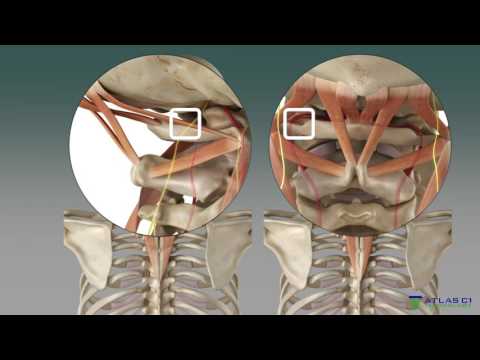 Atlaskorrektur + Körperausrichtung hilft bei vielen Beschwerden