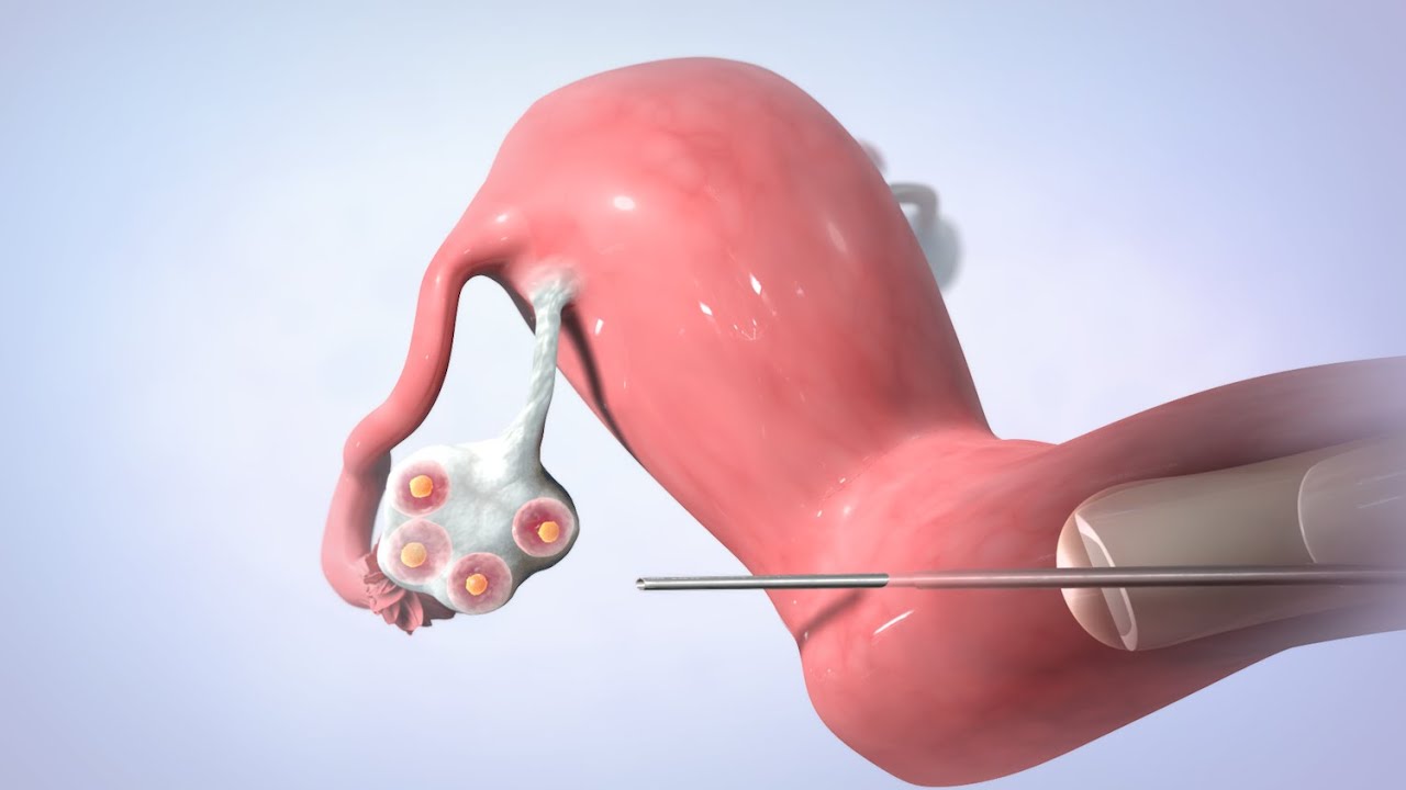 Griselda Reyes Torres-114