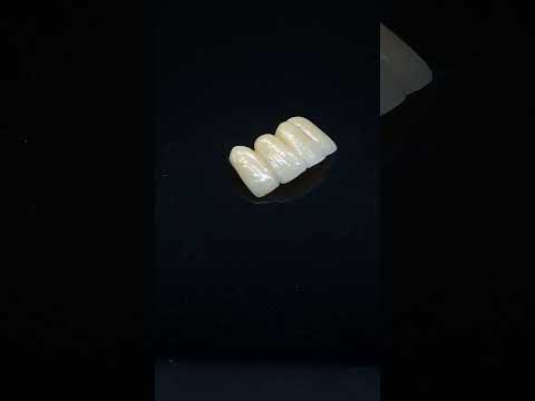YouTube 썸네일