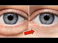 Geschwollene Augen in 20 Minuten entfernen mit DIESEM Trick💥(Schnell & Einfach)🤯