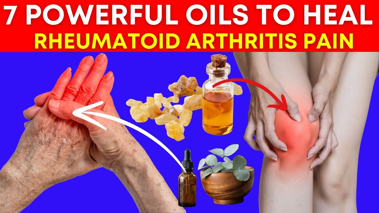 Top 7 Powerful Oils TO Heal Rheumatoid Arthritis Pain Naturally