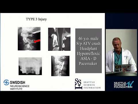 Hangman's Fractures - Jens R. Chapman, MD