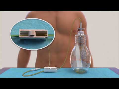 How to Drain a Pleurx Catheter