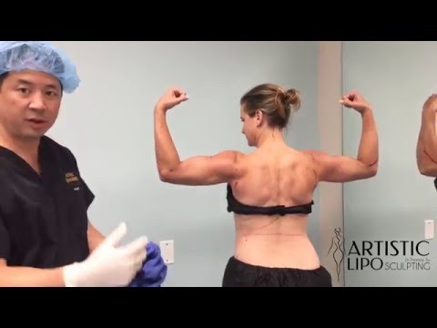 Osteoartrite prima articolazioni metatarso trattamento 2 gradi Tosse, dolori temperatura articolazioni