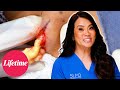 Small Bump Gives A BIG Ooze Dr Pimple Popper Breaking Out S1 Lifetime