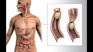 Mechanism Process Food in Mouth, Esophagus and Stomach