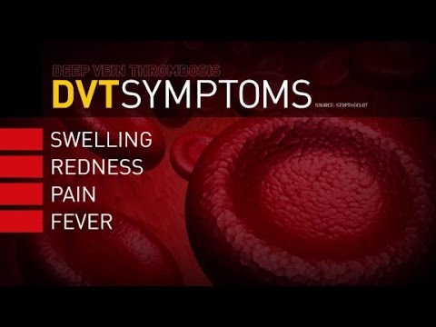 Deep Vein Thrombosis