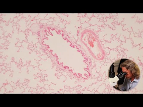 Histology of the airway and lungs