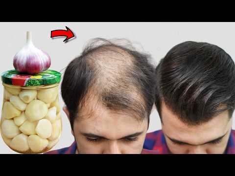 The hair on my bald spot is growing like crazy - incredible results! 100% efficiency!