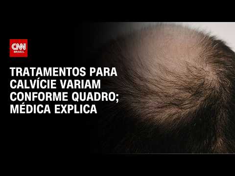 Transplante capilar não é única solução para calvície: veja alternativas | CNN SINAIS VITAIS