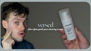 versed skin refine gentle pore clearing serum | trial + review