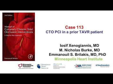 Case 113: Manual of CTO Interventions: CTO PCI in prior TAVR patient