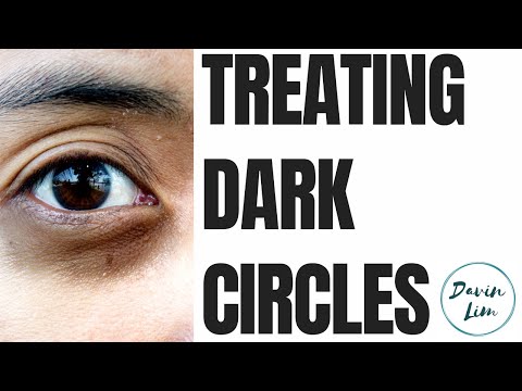 Dark Circles | Cause & Solutions