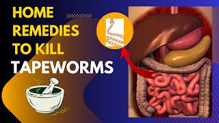HOME REMEDIES TO KILL TAPEWORMS IN HUMAN | kill parasites  Naturally