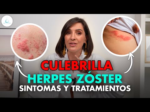 🔴 What you MUST KNOW about shingles | Symptoms and Treatment @drapilarochoa - Dermatologist
