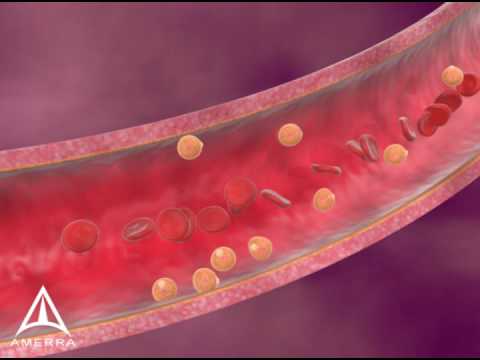 Cholesterol - 3D Medical Animation
