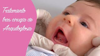 Tratamiento tras la cirugía de anquiloglosia o frenectomía lingual. 👅👶🏼