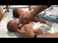 Newborn Twins in NICU Care  Gentle Cleanup & Healthy Reflux Nursery Video 