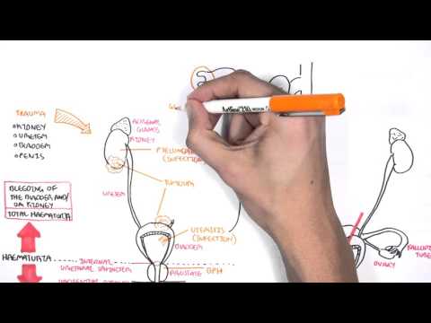 Amoxicillin prostatitis