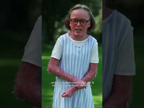 Nynke heeft Ichtyosis met Confetti - Je Zal Het Maar Hebben Jr. #JZHMH #IchtyosisMetConfetti #Huid