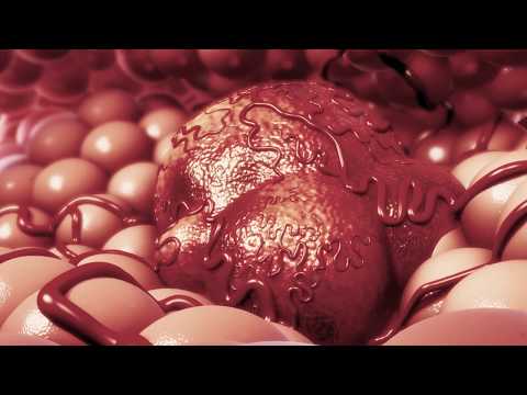 Cellular Senescence & Cancer