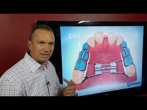 Interceptive Orthodontic Treatment