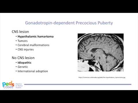 Puberty and Pubertal Disorders   Part 2  Precocious Puberty