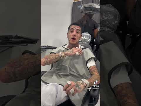 Islandboy taking out his Diamond grills for Veneers 💎🥶