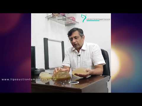 Umangkas sa mga elbows para sa pagbaba ng timbang mga review Ang mga pangalan ng herbs mula sa kung saan upang mawala ang timbang