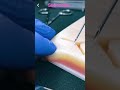 Why is it important to inject with the bevel up| Health care by Dr. Arushi