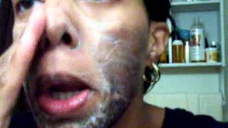 Jessner's Chemical Peel 30% with 20% Salicylic Acid on top- Morning 6- Face Wash