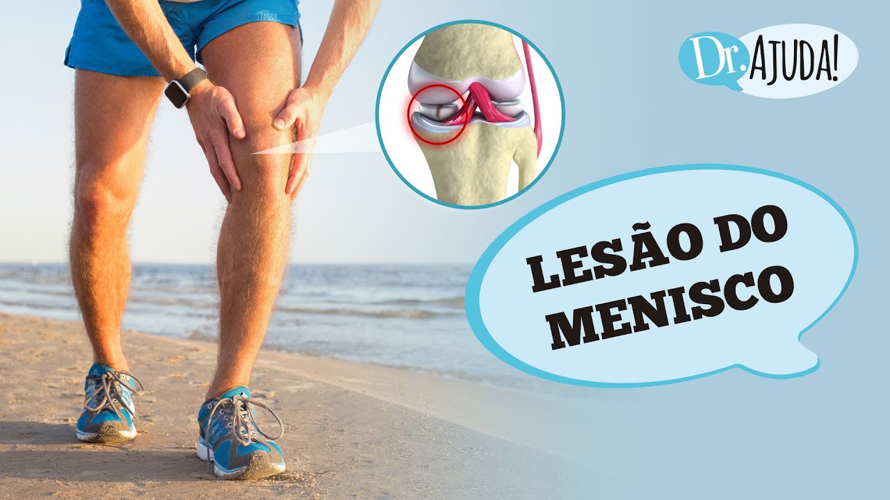 LESÃO DO MENISCO: O QUE É, SINTOMAS, CAUSAS, DIAGNÓSTICO E TRATAMENTO