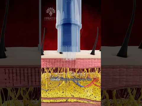 How Can the Derma Pen Transform Your Skin😲 #shorts #microneedling #viralvideo - creativelearning3d