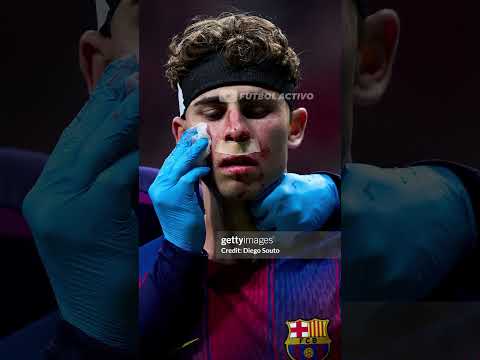 el mejor torneo de la historia