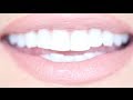 How to Get Really White Teeth For Cheap | Kandee Johnson