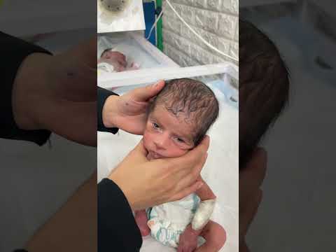 little baby relaxing #premature #miraclebaby #cutebaby #littlebaby #littlebaby #little #newborn #new