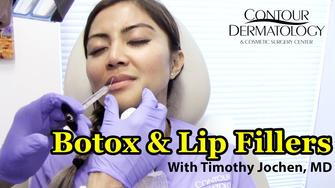 First Time Patient Xarlyn Gets Botox & Lip Fillers | Contoured by Dr. Jochen