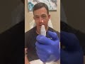 Doctor Puts A Hole In His Own Nail Immediate Relief 208SkinDoc