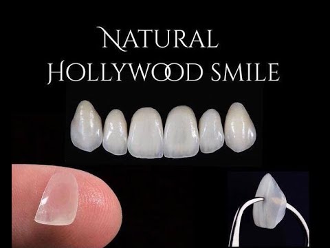 Hollywood Smile | Dr Imran Al Morabit - Cosmetic Dentist | Nador Morocco