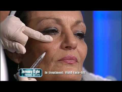 Fluid Facelift - instant, live results on ITV by Miss Jonquille Chantrey