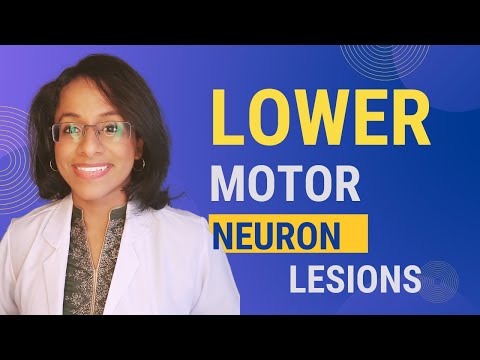 Deviates to which side? Tongue, Lips,Uvula,Jaw